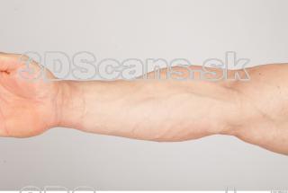 Forearm texture of Gene 0001